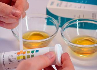 Кетоновые тела в анализе мочи у женщин