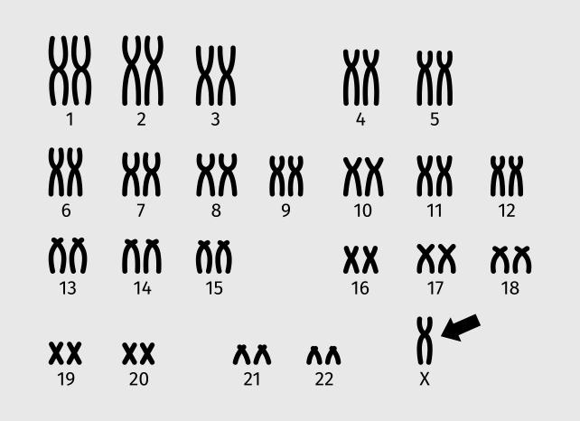 Кариотип человека в норме Кариотип человека в норме