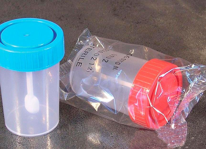 Как взять анализ кала взрослому