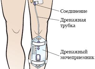 Как очистить мочу перед анализом