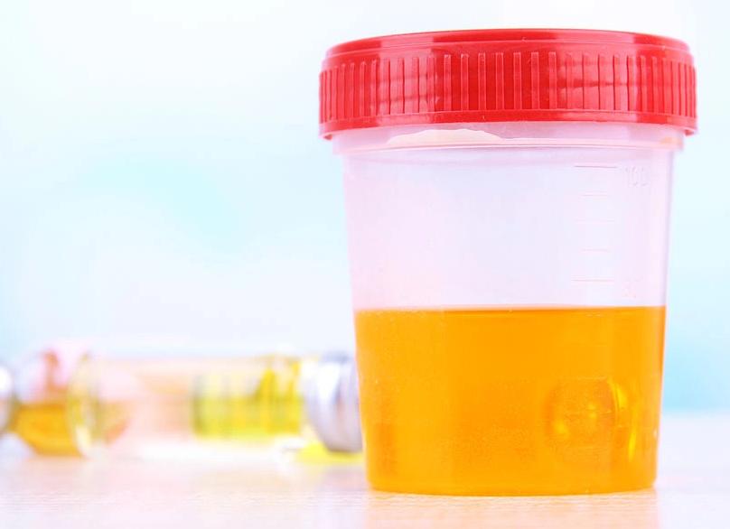 Как алкоголь влияет на анализ мочи