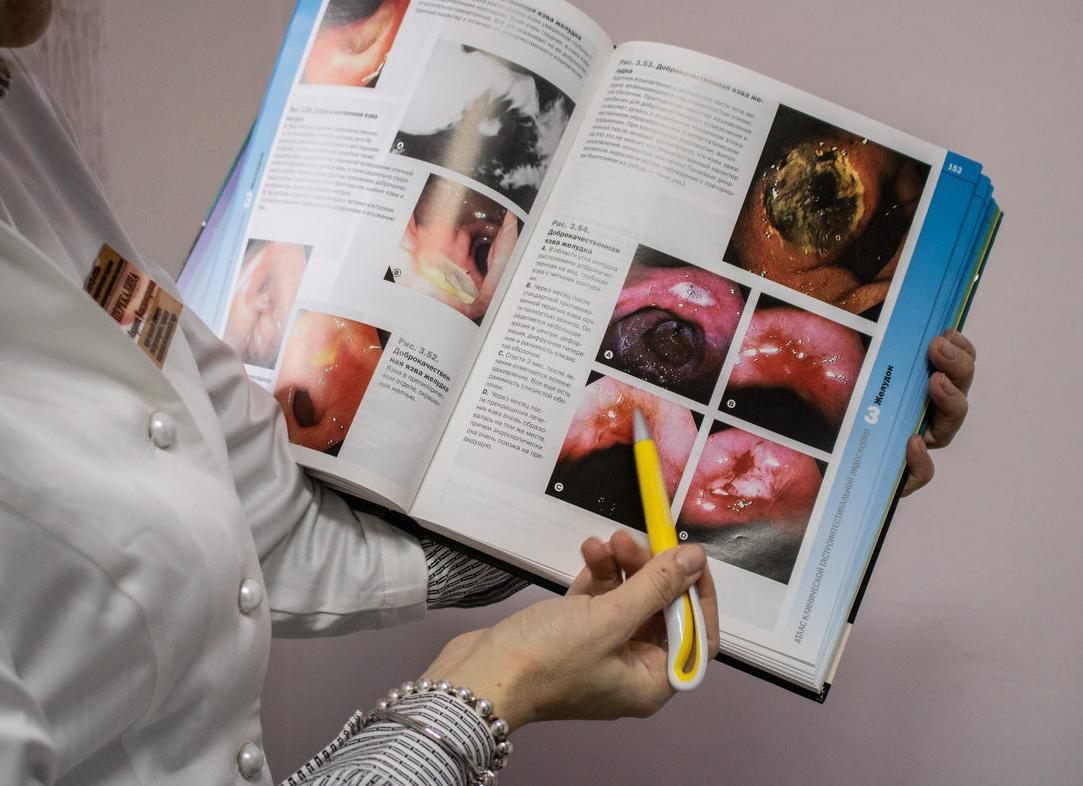 Хронический субатрофический гастрит