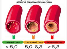 Холестерин 3 6