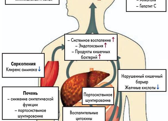 Энцелофапатия печени что это такое