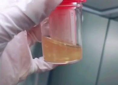 Что то белое плавает в моче Что то белое плавает в моче