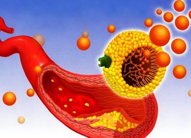 Что такое липиды в крови