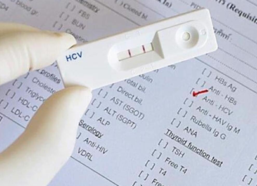 Антитела к вгс это что