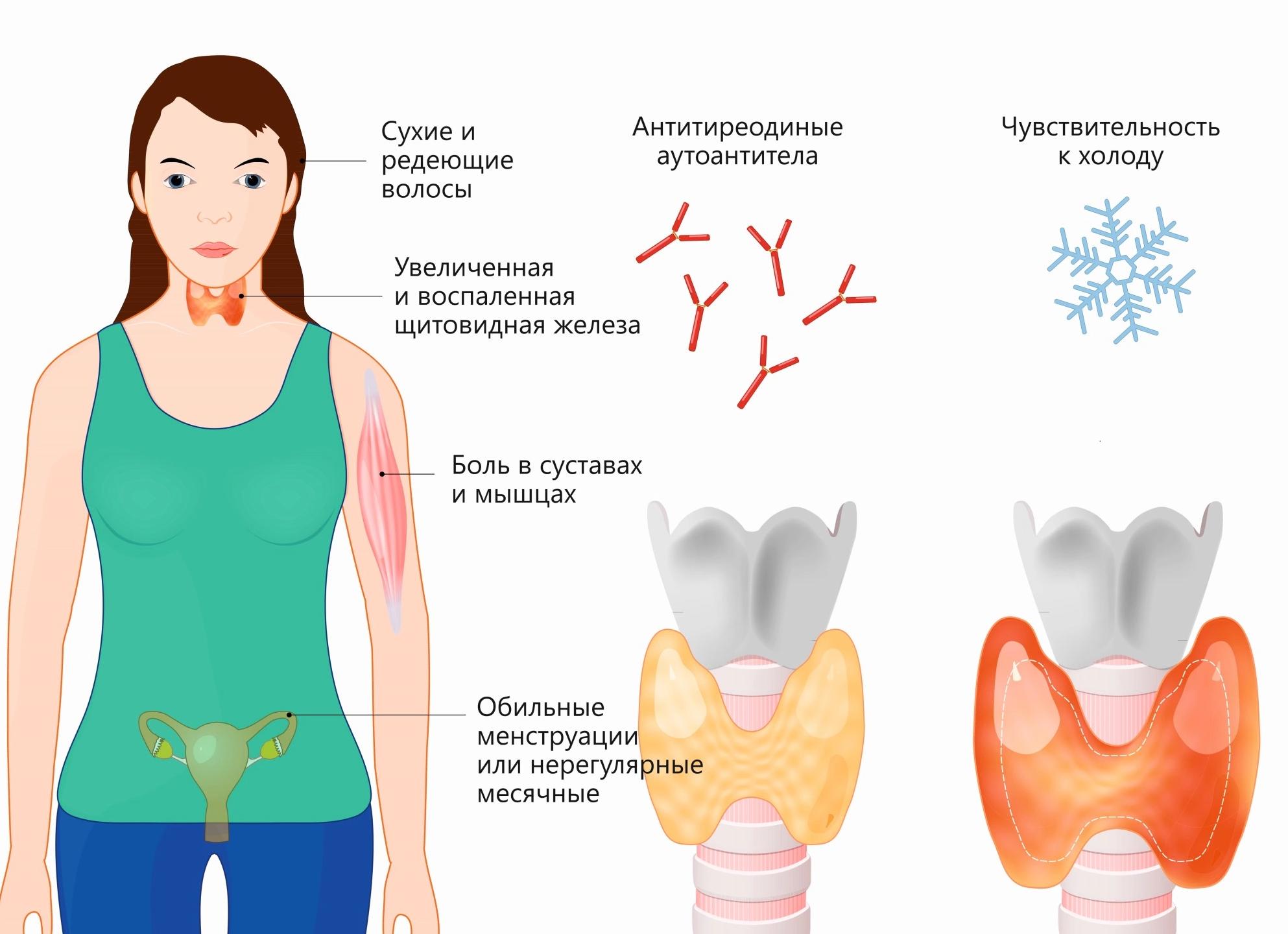 Анти тпо повышен чем опасно