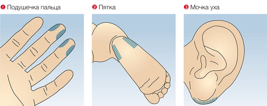 Капиллярная кровь откуда берется