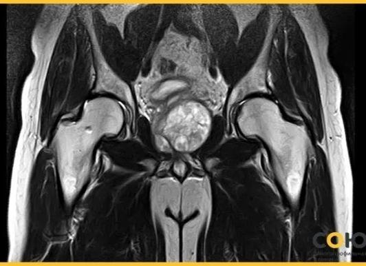 Мрт тазобедренного сустава сколько стоит