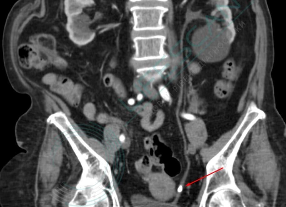 Кт внутренних органов Кт внутренних органов