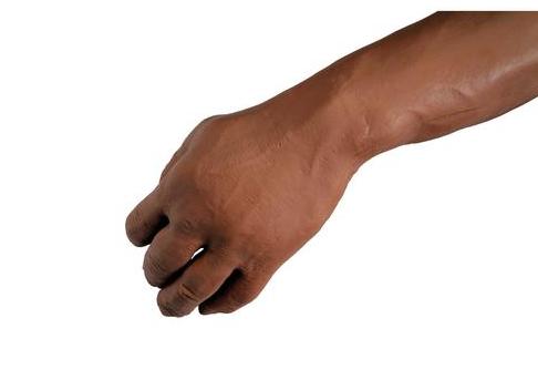 Кровь из вены светлая