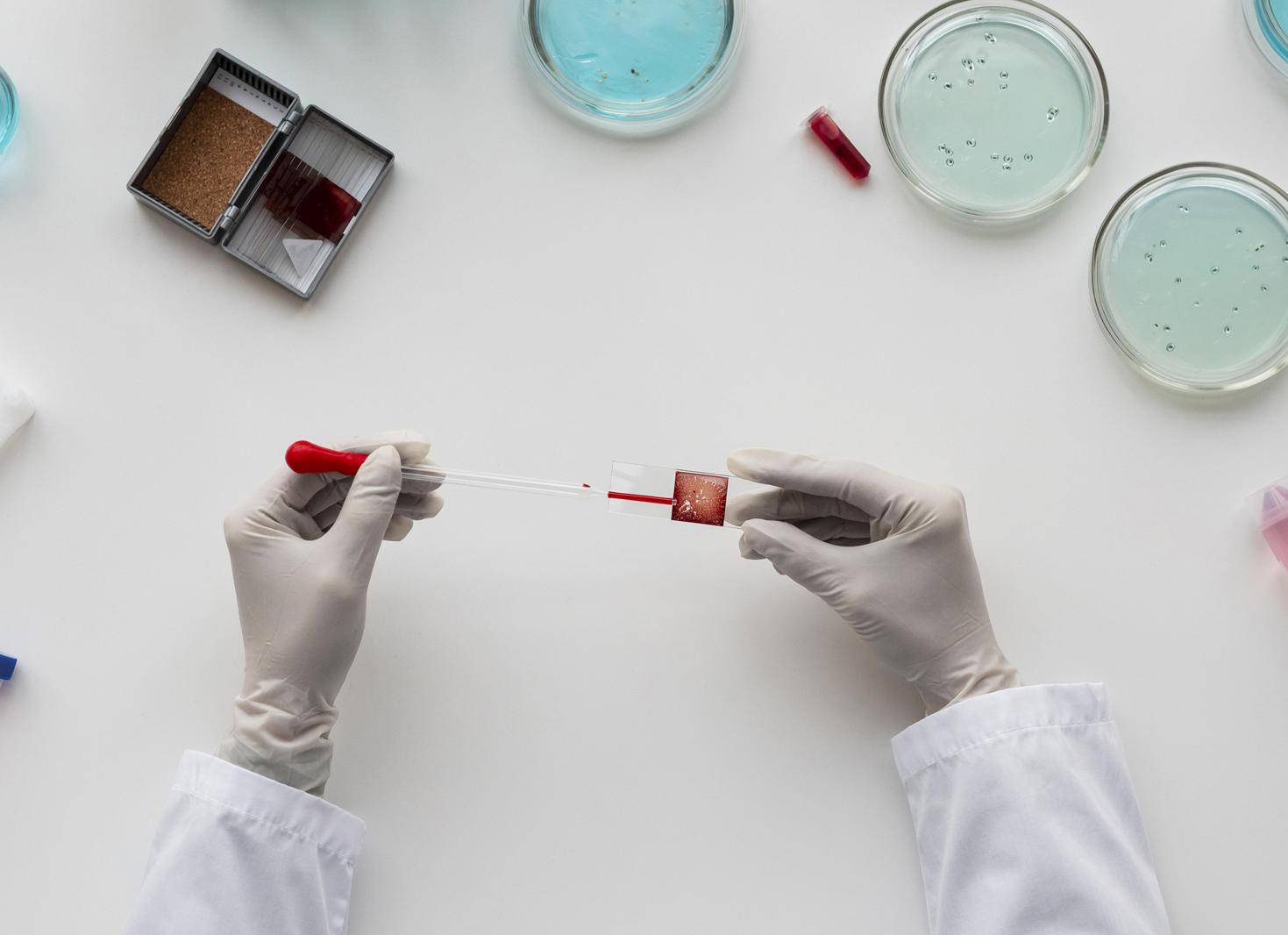 Как подготовиться к сдаче гормонов Как подготовиться к сдаче гормонов