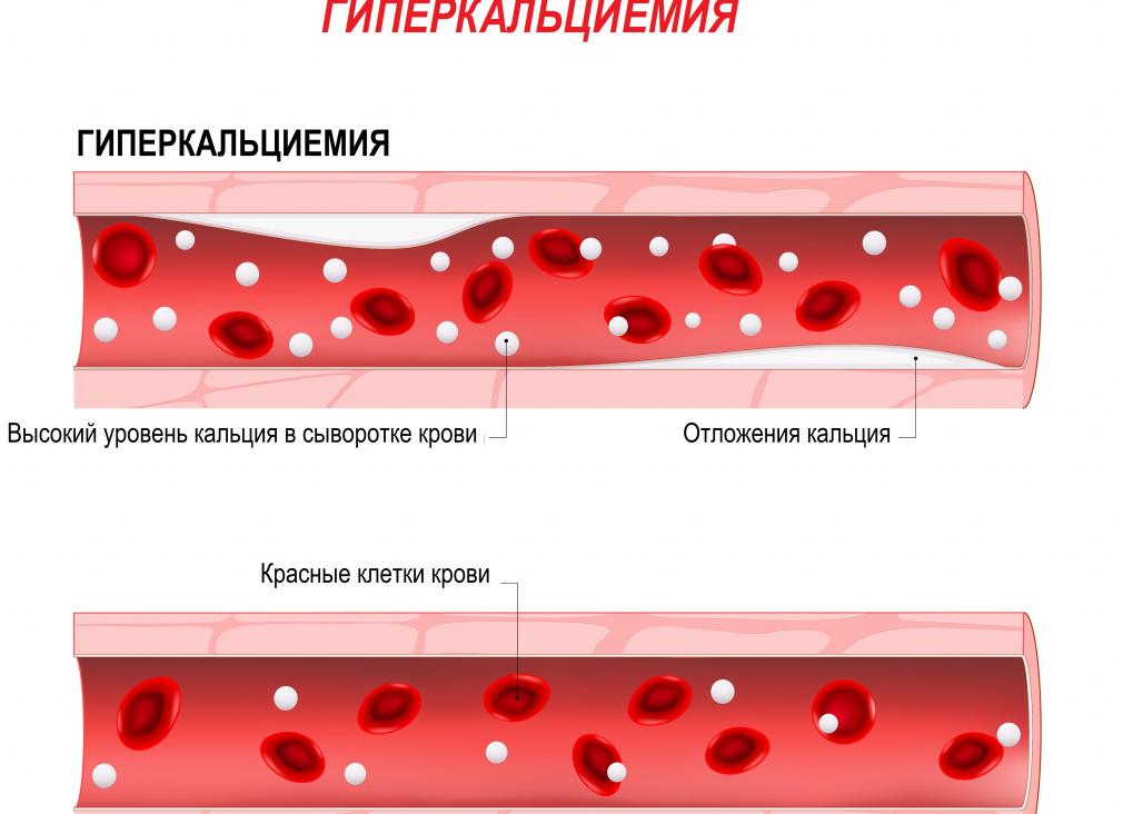 Ионизированный кальций понижен причины