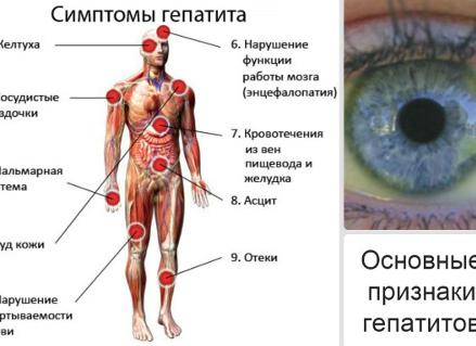 Гепатит с последствия Гепатит с последствия