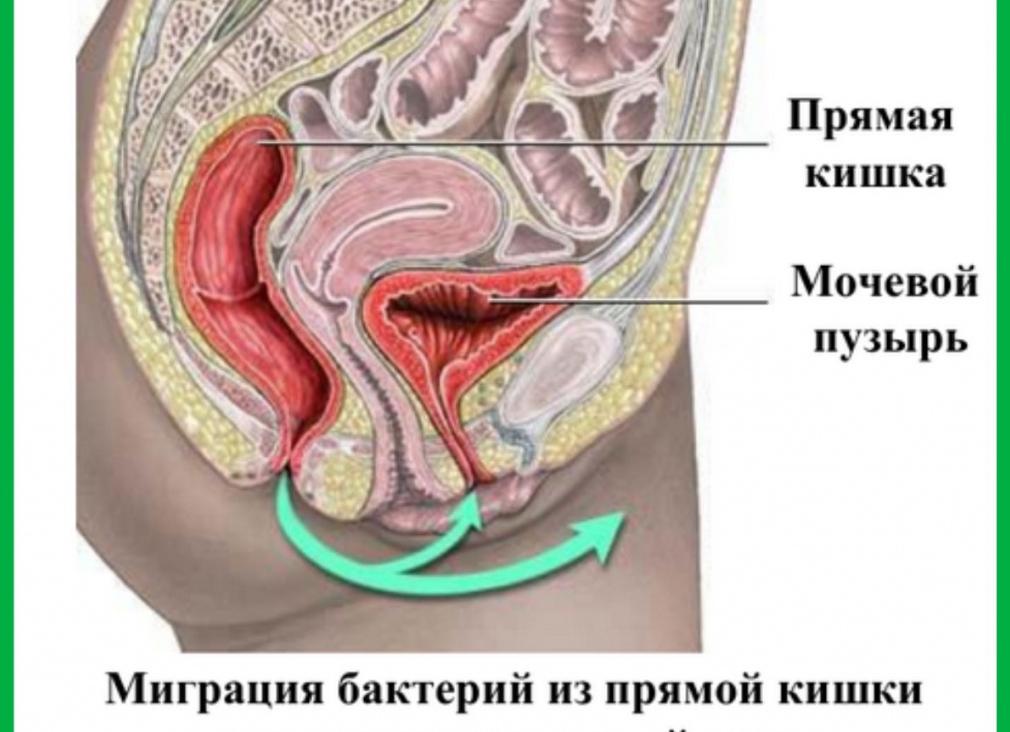 Е коли в моче
