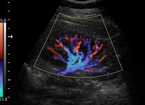 Допплерография что это такое