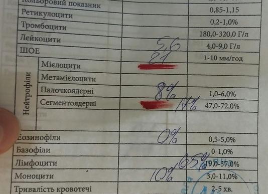 Что значит соэ 45 у ребенка