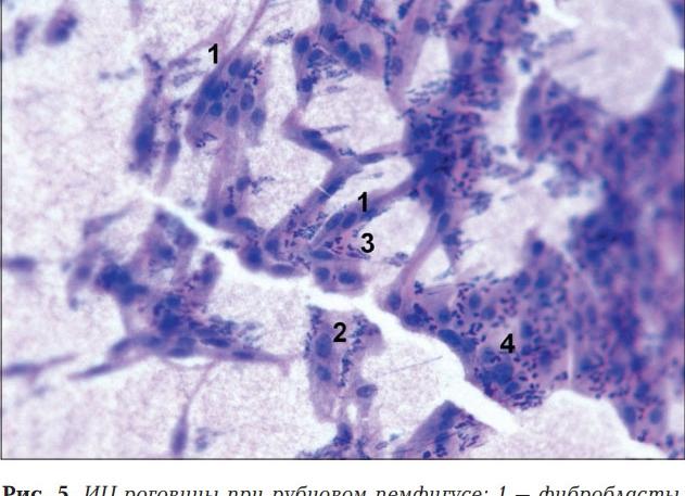 Что такое кокковая флора