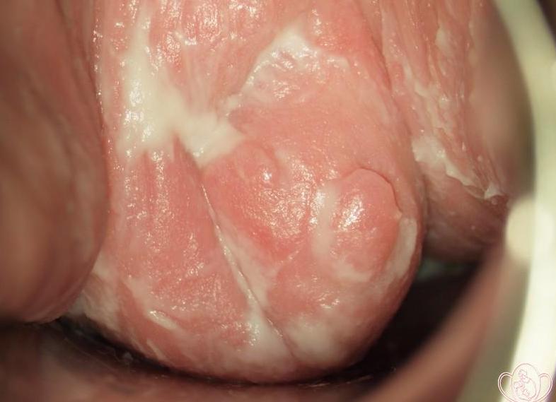 Белые выделения без запаха у женщин