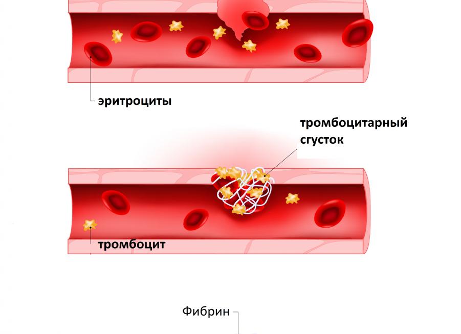 Анализ крови на гемостаз что показывает Анализ крови на гемостаз что показывает