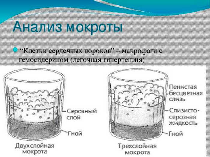 Как собрать правильно мокроту