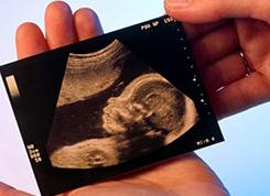 Можно ли на 13 неделе узнать пол ребенка Можно ли на 13 неделе узнать пол ребенка