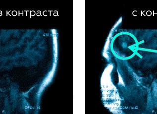 Контраст при мрт