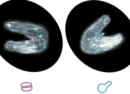 Когда видно пол ребенка по узи на каком сроке