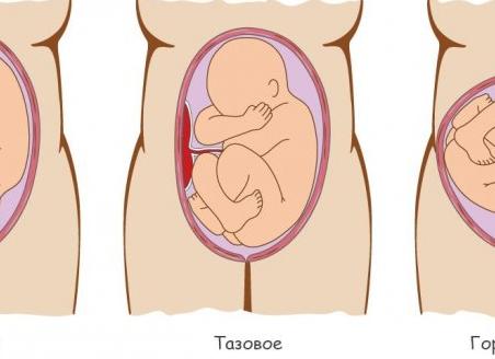 Как лежит ребенок в животе на 30 неделе
