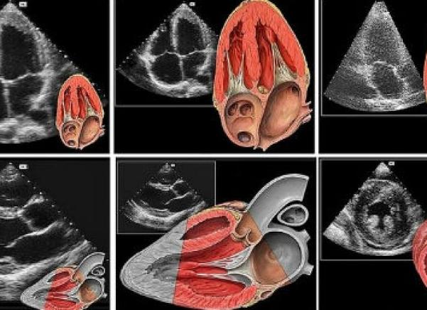 Экг и эхо сердца в чем разница