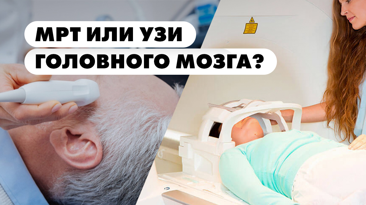 Как делают узи головного мозга взрослого человека