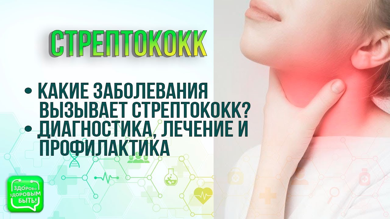 Как лечить стрептококки в горле