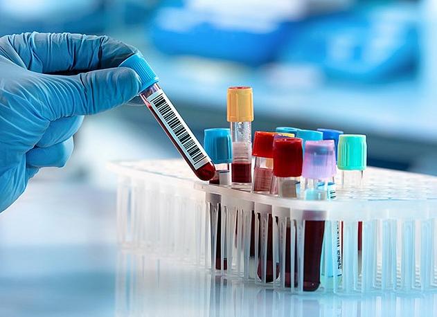 Можно ли курить перед анализами Можно ли курить перед анализами