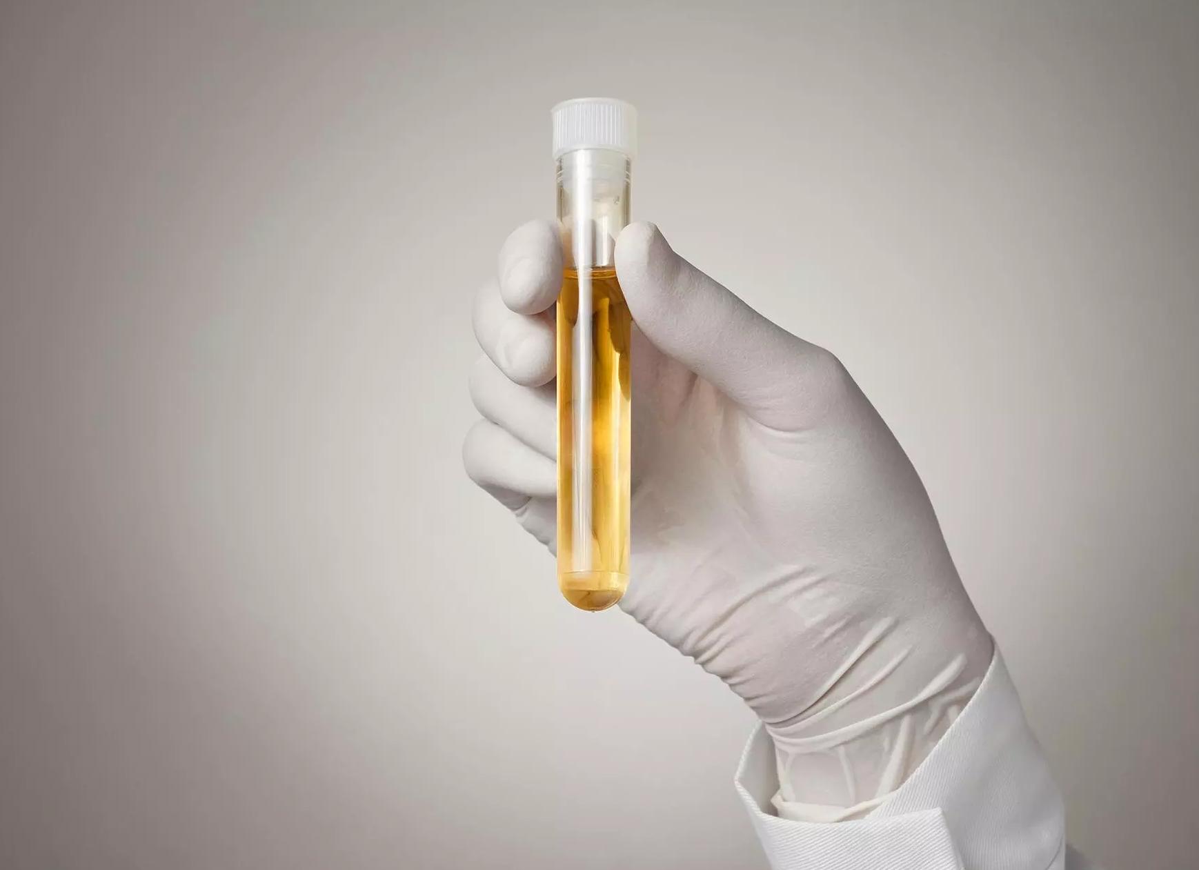 Мочи по амбурже