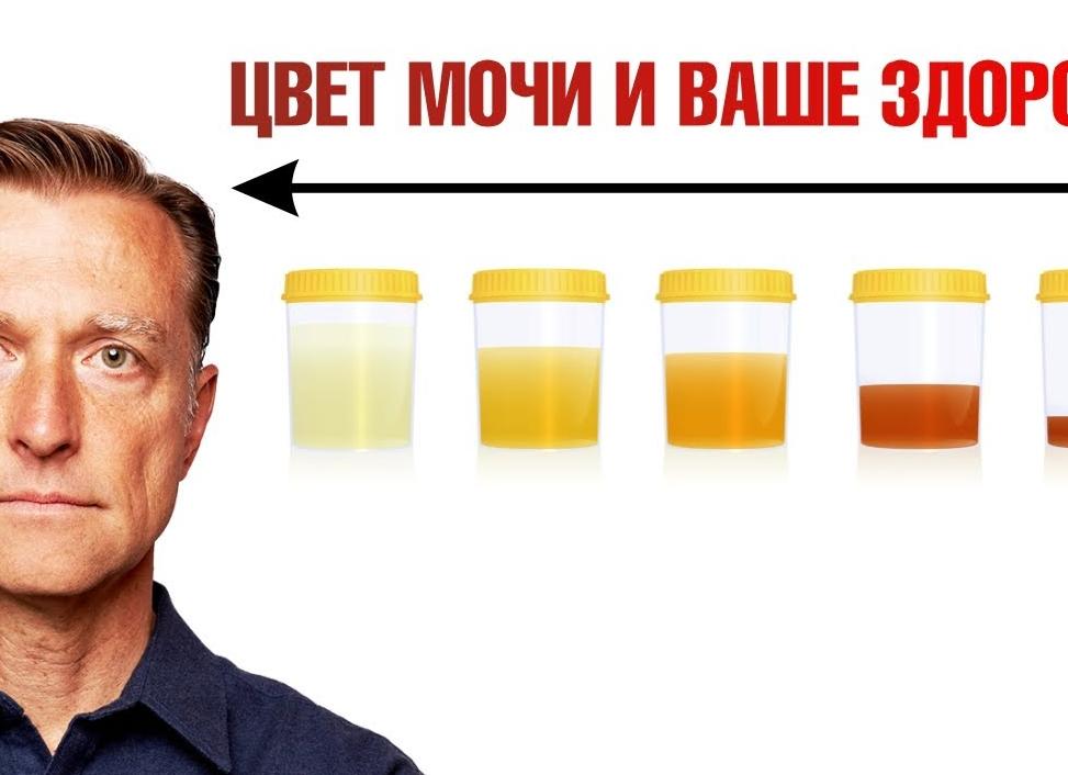 Моча оранжевого цвета