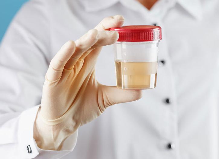 Лейкоциты повышены у ребенка в моче о чем это говорит Лейкоциты повышены у ребенка в моче о чем это говорит