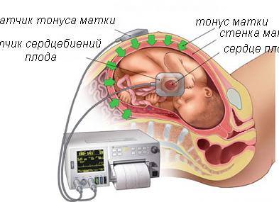 Ктг плода аппарат