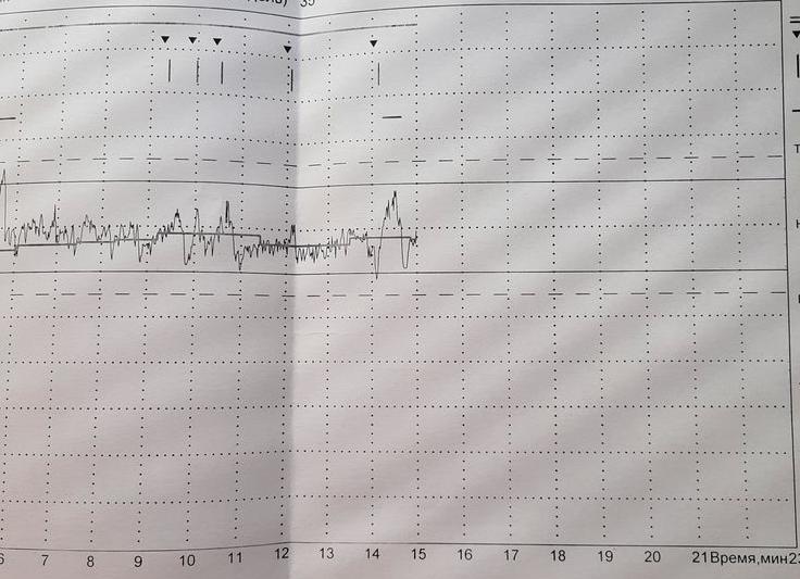Ктг 9 баллов что значит