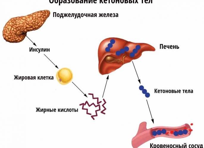 Кетоновые тела в моче причины