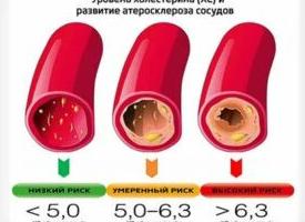 Как быстро снизить холестерин