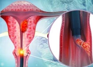 Хронический как это