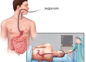 Фгдс как проводится
