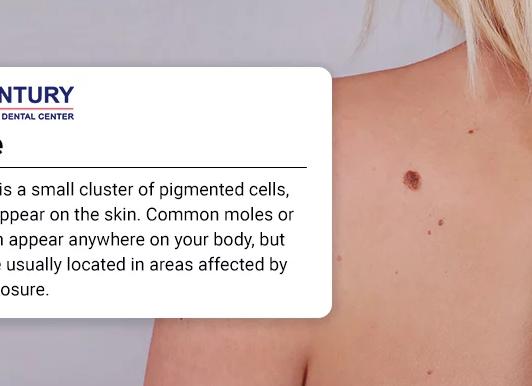 Если повредилась родинка врач