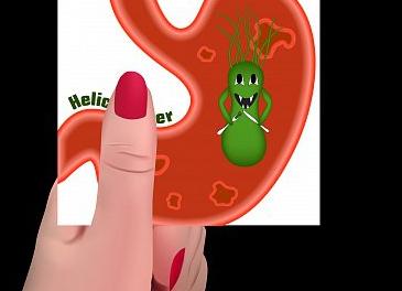 Эрадикация что это такое