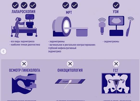 Эндометриоз диагностика узи