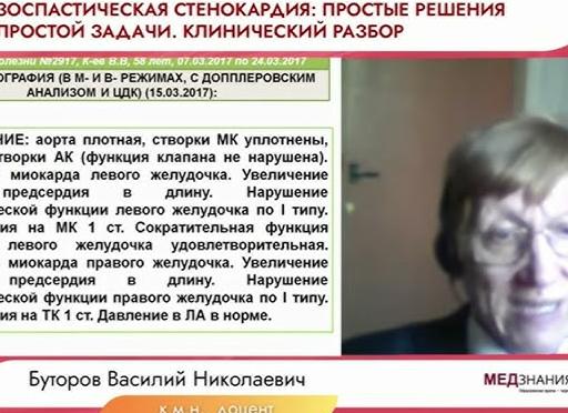 Эхокардиография с допплеровским анализом и цдк