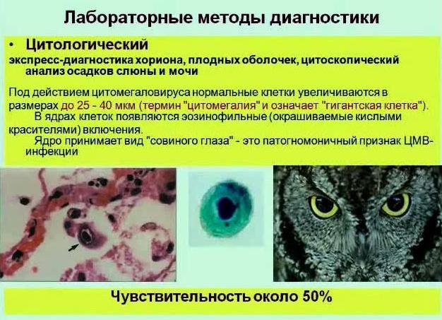 Цитологический анализ слюны