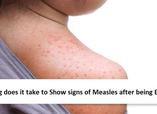 Через какое время после заражения в крови можно обнаружить вич