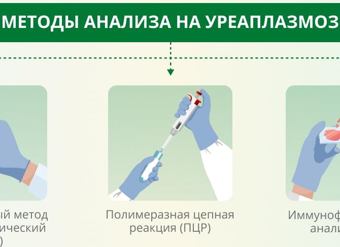 Анализы на уреаплазму у женщин Анализы на уреаплазму у женщин